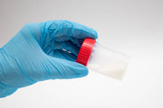 Abnormal semen